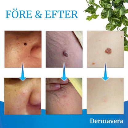 Dermaskin Pro™ - Den smarta lösningen mot hudflikar
